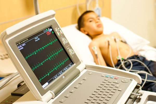 Electrocardiogram
